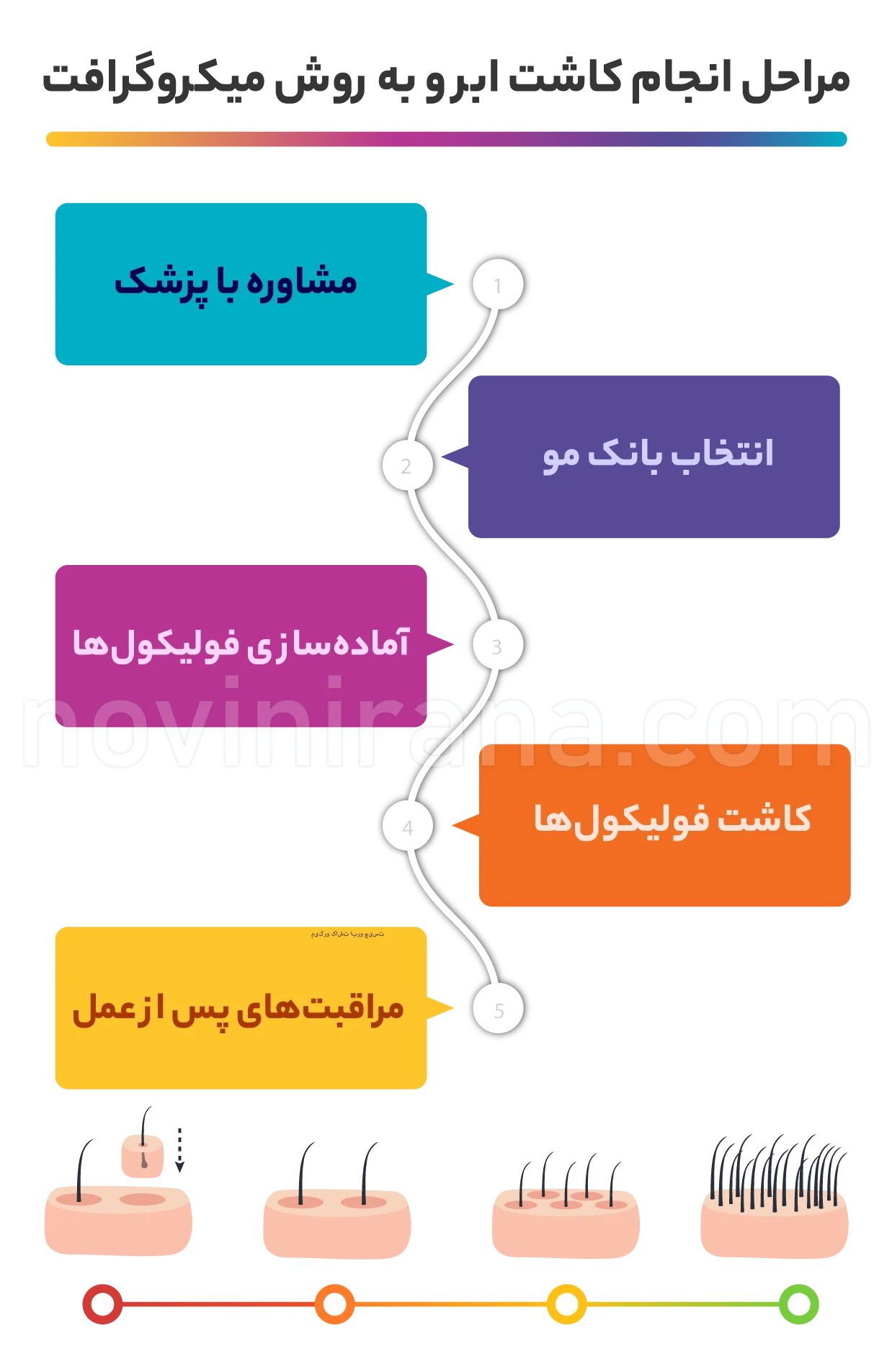 مراحل اجرای عمل میکرو کاشت ابرو
